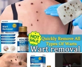 WART REMOVER