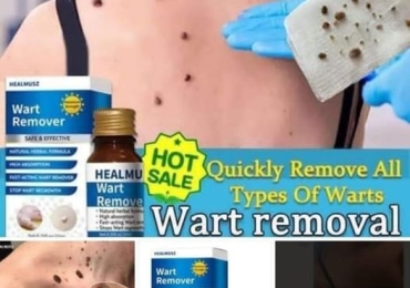 WART REMOVER